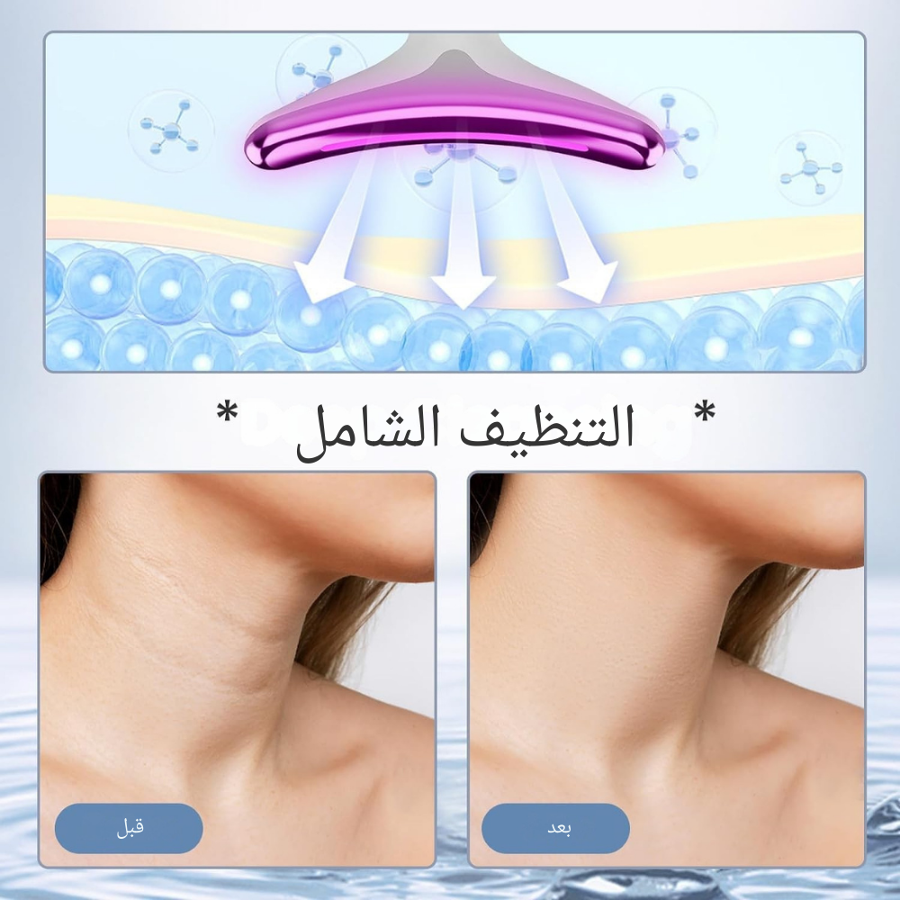 Appareil Anti-Rides à Lumière Pulsée Intense ES-1081™ - Votre Secret Jeunesse.