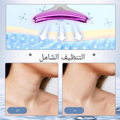 Appareil Anti-Rides à Lumière Pulsée Intense ES-1081™ - Votre Secret Jeunesse.